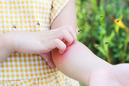 The girl is itching from mosquito bite