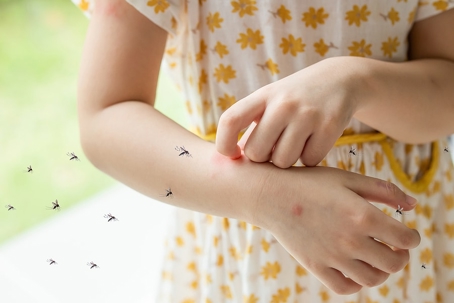 A girl is being bitten by mosquitos