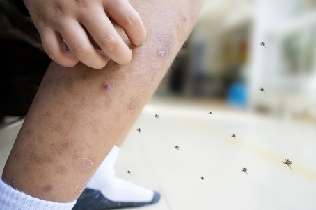 A person is itching from mosquito bite